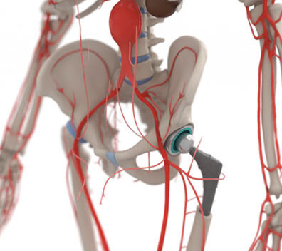 bone hips with veins